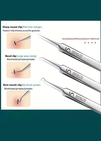 Набір для чищення пор обличчя та видалення прищів, вугрів, акне, 8 предметів у футлярі JCD (319156635)