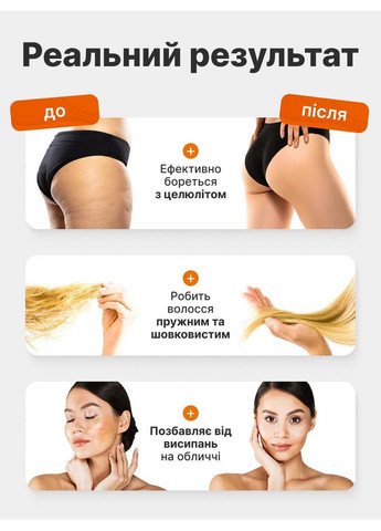 Дарсонваль для догляду за волоссям шкірою обличчя та тіла Косметологічний апарат Гребінець для дарсонвалізації Medica+ LZ-006A (361348601)