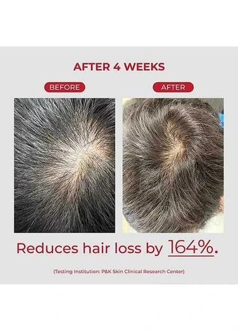 Шампунь Annurcatin Shampoo для зміцнення та надання об'єму волоссю 300 мл MOEV (382518366)