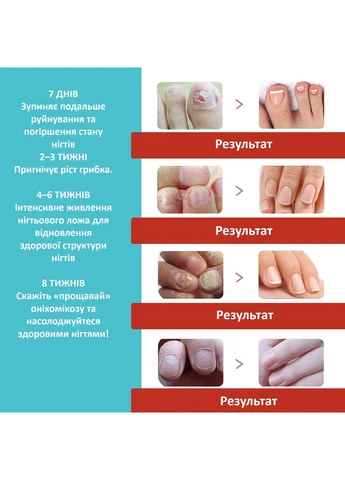 Пластырь-наклейки для коррекции вросшего ногтя Nail Patches в упаковке 16 шт 9360 No Brand (402247350)