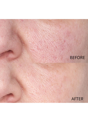 Сироватка для шкарпеток, що вирізняє Hypoallergenic Clean Correction Smoothing Restorative Serum Perricone MD (368561485)