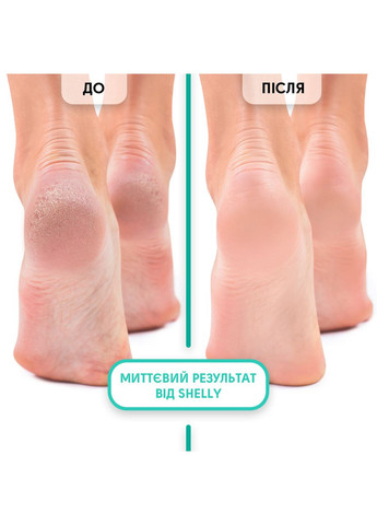 Пінний експрес-розм'якчувач для педикюру М'яке лезо Shelly 150 мл Ноготок (303358060)