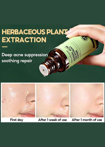 Тонер для лица Vibrant для проблемной кожи 100мл Glamour (313262768)