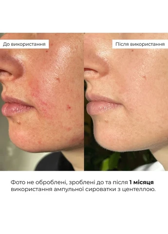 Комплекс для борьбы с отеками и тусклой кожей Anti-Puffiness & Dullness Skin Care Complex Hillary (387371224)