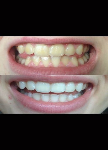 Набор для відбілювання зубів 3D Brilliance White 32 полоски Crest (280265815)